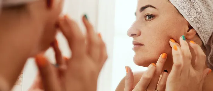 Tipologie di acne e prodotti specifici