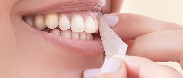Strisce sbiancanti denti in farmacia