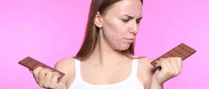 Miti e verità sull'acne ormonale