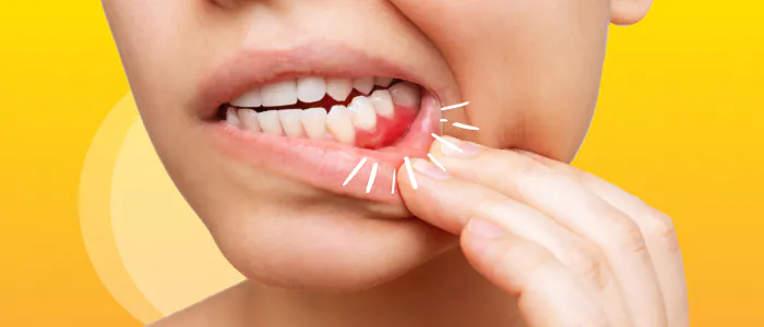 Migliore dentifricio per gengive infiammate e sensibili: i 5 TOP del 2024